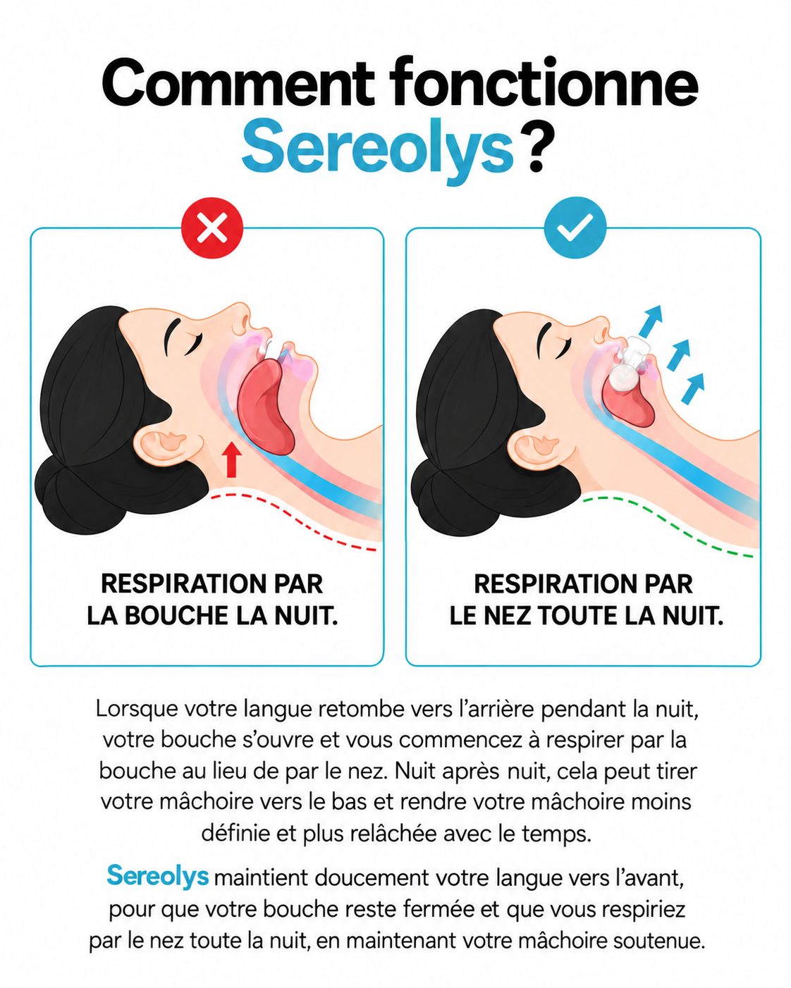 Dispositif de positionnement de la langue Sereolys