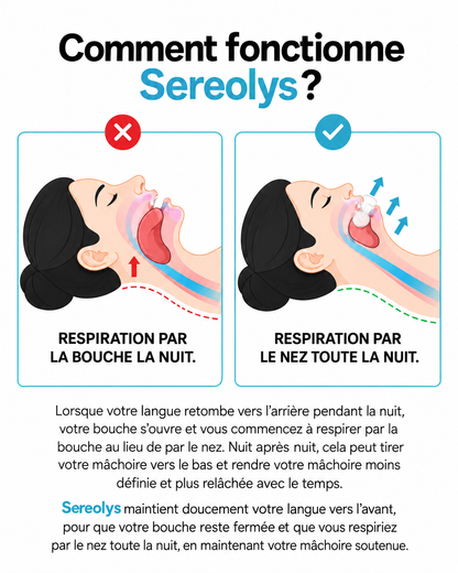 Dispositif de positionnement de la langue Sereolys