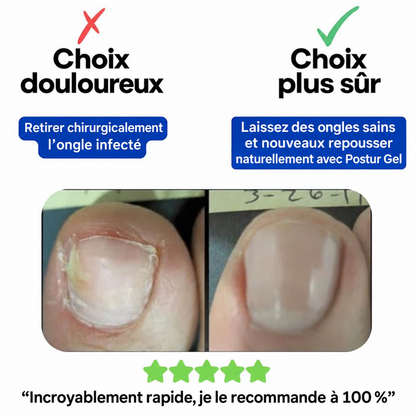 Patchs réparateurs pour ongles Sereolys