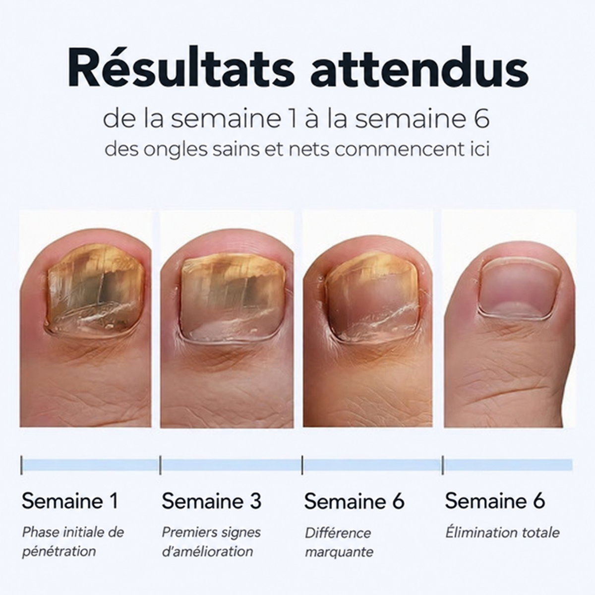 Patchs réparateurs pour ongles Sereolys