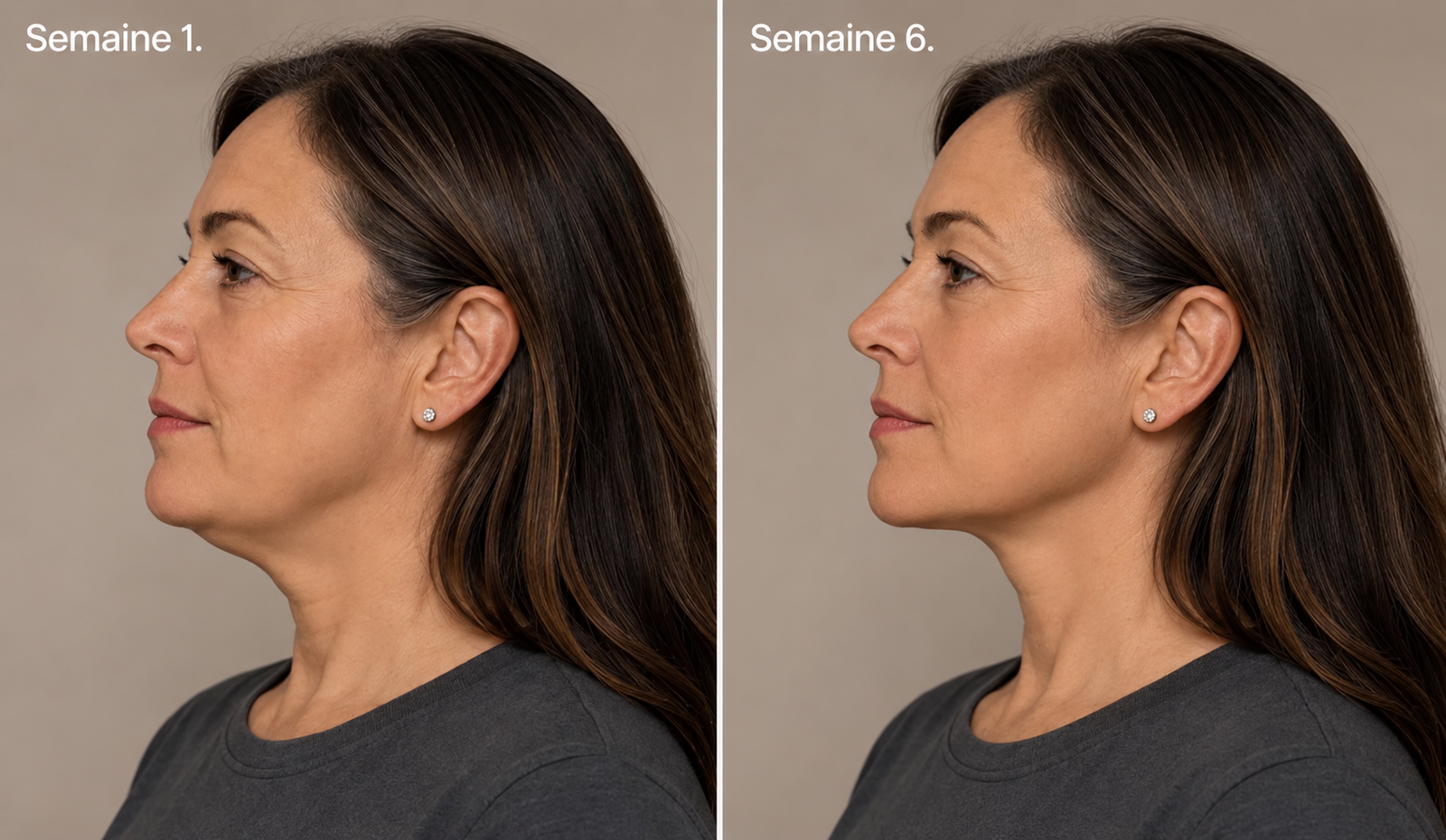 Le profil de Caroline à la semaine 1 puis à la semaine 6 avec Restflow, même éclairage et même angle